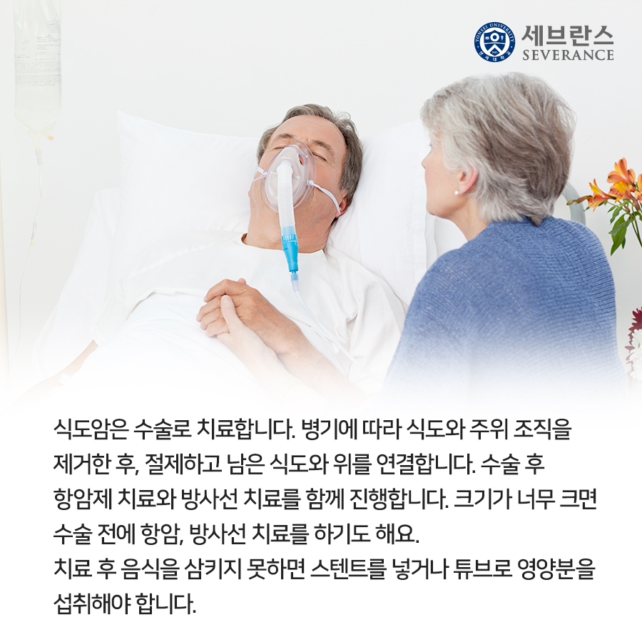 식도암은 수술로 치료합니다. 병기에 따라 식도와 주위 조직을 제거한 후, 절제하고 남은 식도와 위를 연결합니다. 수술 후 항암제 치료와 방사선 치료를 함께 진행합니다. 크기가 너무 크면 수술 전에 항암, 방사선 치료를 하기도 해요. 치료 후 음식을 삼키지 못하면 스텐트를 넣거나 튜브로 영양분을 섭취해야 합니다.